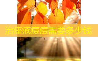 治痤疮痘痘需要多少钱
