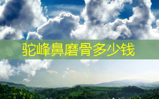 驼峰鼻磨骨多少钱
