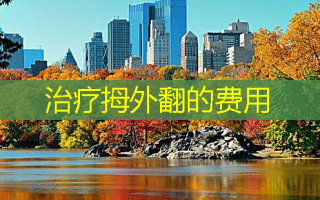 治疗拇外翻的费用