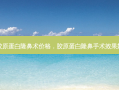 胶原蛋白隆鼻术价格，胶原蛋白隆鼻手术效果好