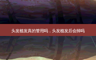头发植发真的管用吗，头发植发后会掉吗