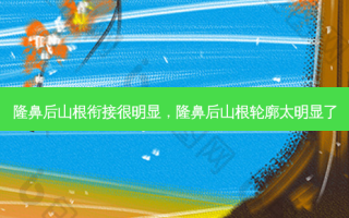 隆鼻后山根衔接很明显，隆鼻后山根轮廓太明显了