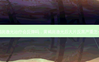 黄褐斑激光治疗会反弹吗，黄褐斑激光后大片反黑严重怎么治