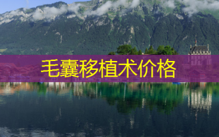 毛囊移植术价格