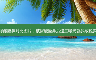 玻尿酸隆鼻对比图片，玻尿酸隆鼻后遗症曝光就我敢说实话