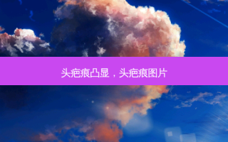 头疤痕凸显，头疤痕图片