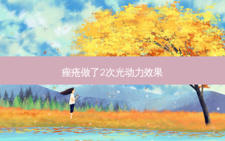 痤疮做了2次光动力效果