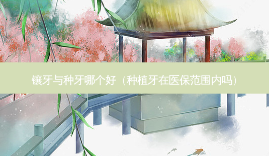 镶牙与种牙哪个好(种植牙在医保范围内吗)-第1张图片-南山整形网 镶牙与种牙哪个好(种植牙在医保范围内吗)-第1张图片-南山整形网