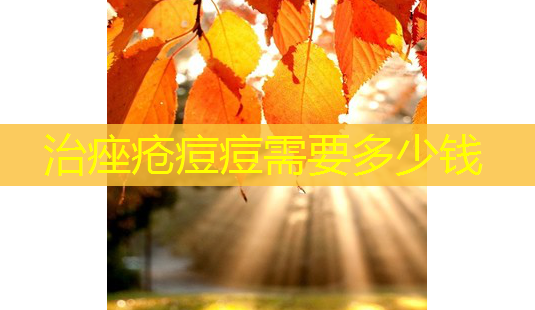 治痤疮痘痘需要多少钱-第1张图片-南山整形网 治痤疮痘痘需要多少钱-第1张图片-南山整形网