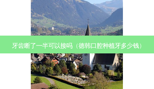 牙齿断了一半可以接吗(德韩口腔种植牙多少钱)-第1张图片-南山整形网 牙齿断了一半可以接吗(德韩口腔种植牙多少钱)-第1张图片-南山整形网