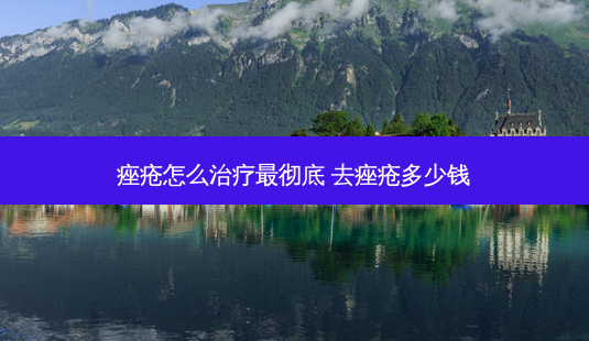 痤疮怎么治疗最彻底 去痤疮多少钱-第1张图片-南山整形网 痤疮怎么治疗最彻底 去痤疮多少钱-第1张图片-南山整形网