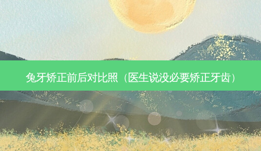 兔牙矫正前后对比照(医生说没必要矫正牙齿)-第1张图片-南山整形网 兔牙矫正前后对比照(医生说没必要矫正牙齿)-第1张图片-南山整形网