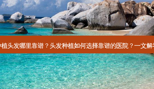 种植头发哪里靠谱?头发种植如何选择靠谱的医院?一文解答-第1张图片-南山整形网 种植头发哪里靠谱?头发种植如何选择靠谱的医院?一文解答-第1张图片-南山整形网