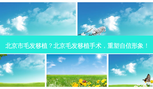 北京市毛发移植?北京毛发移植手术,重塑自信形象!-第1张图片-南山整形网 北京市毛发移植?北京毛发移植手术,重塑自信形象!-第1张图片-南山整形网
