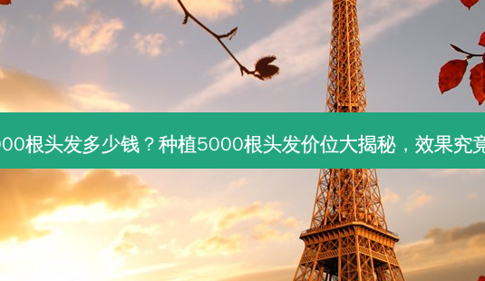 种植5000根头发多少钱?种植5000根头发价位大揭秘,效果究竟如何?-第1张图片-南山整形网 种植5000根头发多少钱?种植5000根头发价位大揭秘,效果究竟如何?-第1张图片-南山整形网
