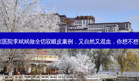 安贞医院李斌斌做全切双眼皮案例,又自然又混血,你想不想要?-第1张图片-南山整形网 安贞医院李斌斌做全切双眼皮案例,又自然又混血,你想不想要?-第1张图片-南山整形网