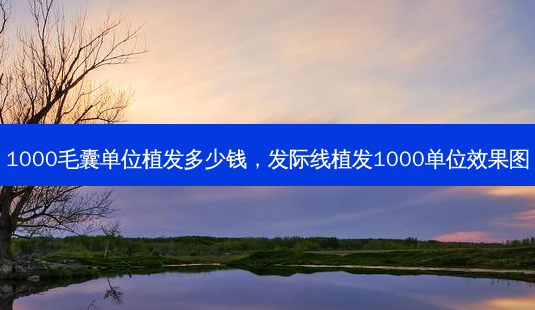 1000毛囊单位植发多少钱,发际线植发1000单位效果图-第1张图片-南山整形网 1000毛囊单位植发多少钱,发际线植发1000单位效果图-第1张图片-南山整形网