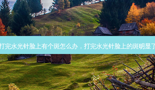打完水光针脸上有个斑怎么办,打完水光针脸上的斑明显了-第1张图片-南山整形网 打完水光针脸上有个斑怎么办,打完水光针脸上的斑明显了-第1张图片-南山整形网