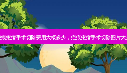 疤痕疙瘩手术切除费用大概多少,疤痕疙瘩手术切除图片大全-第1张图片-南山整形网 疤痕疙瘩手术切除费用大概多少,疤痕疙瘩手术切除图片大全-第1张图片-南山整形网
