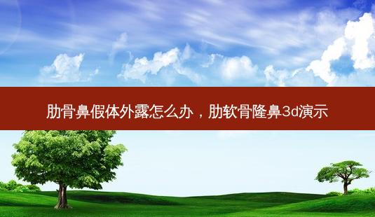 肋骨鼻假体外露怎么办,肋软骨隆鼻3d演示-第1张图片-南山整形网 肋骨鼻假体外露怎么办,肋软骨隆鼻3d演示-第1张图片-南山整形网