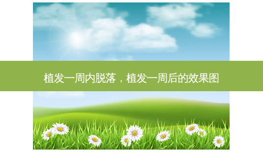 植发一周内脱落,植发一周后的效果图-第1张图片-南山整形网 植发一周内脱落,植发一周后的效果图-第1张图片-南山整形网