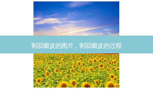 割双眼皮的图片,割双眼皮的过程-第1张图片-南山整形网 割双眼皮的图片,割双眼皮的过程-第1张图片-南山整形网