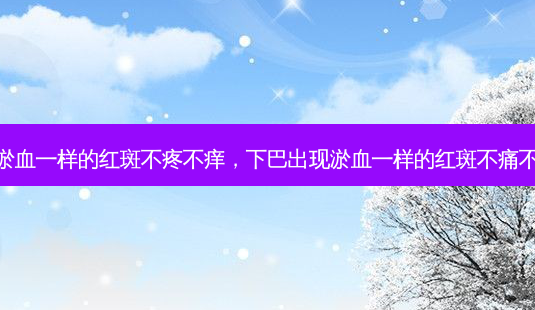 下巴出现淤血一样的红斑不疼不痒,下巴出现淤血一样的红斑不痛不痒怎么办-第1张图片-南山整形网 下巴出现淤血一样的红斑不疼不痒,下巴出现淤血一样的红斑不痛不痒怎么办-第1张图片-南山整形网