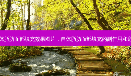自体脂肪面部填充效果图片,自体脂肪面部填充的副作用和危害-第1张图片-南山整形网 自体脂肪面部填充效果图片,自体脂肪面部填充的副作用和危害-第1张图片-南山整形网