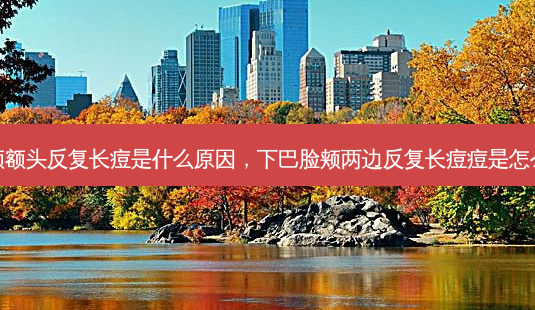 下巴脸颊额头反复长痘是什么原因,下巴脸颊两边反复长痘痘是怎么回事吗-第1张图片-南山整形网 下巴脸颊额头反复长痘是什么原因,下巴脸颊两边反复长痘痘是怎么回事吗-第1张图片-南山整形网