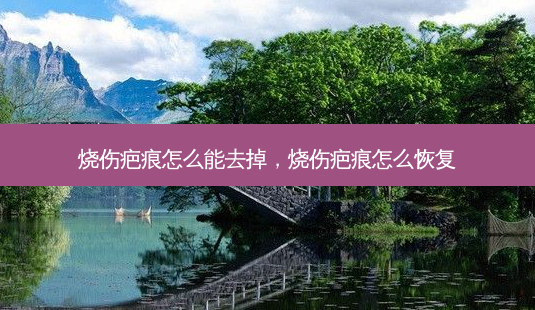 烧伤疤痕怎么能去掉,烧伤疤痕怎么恢复-第1张图片-南山整形网 烧伤疤痕怎么能去掉,烧伤疤痕怎么恢复-第1张图片-南山整形网