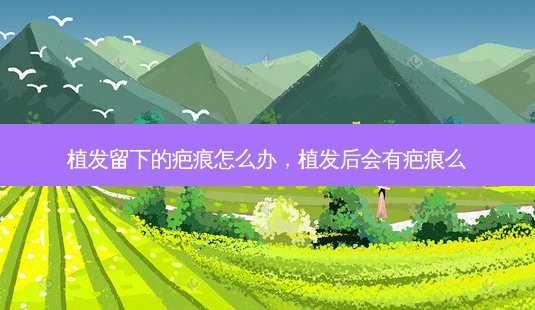 植发留下的疤痕怎么办,植发后会有疤痕么-第1张图片-南山整形网 植发留下的疤痕怎么办,植发后会有疤痕么-第1张图片-南山整形网