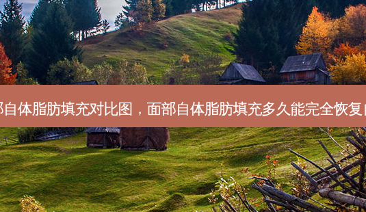 面部自体脂肪填充对比图,面部自体脂肪填充多久能完全恢复自然-第1张图片-南山整形网 面部自体脂肪填充对比图,面部自体脂肪填充多久能完全恢复自然-第1张图片-南山整形网
