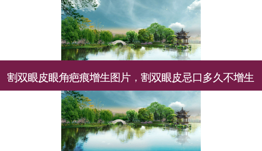 割双眼皮眼角疤痕增生图片,割双眼皮忌口多久不增生-第1张图片-南山整形网 割双眼皮眼角疤痕增生图片,割双眼皮忌口多久不增生-第1张图片-南山整形网
