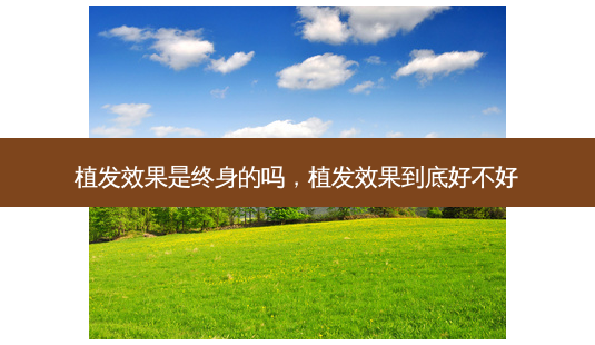 植发效果是终身的吗,植发效果到底好不好-第1张图片-南山整形网 植发效果是终身的吗,植发效果到底好不好-第1张图片-南山整形网