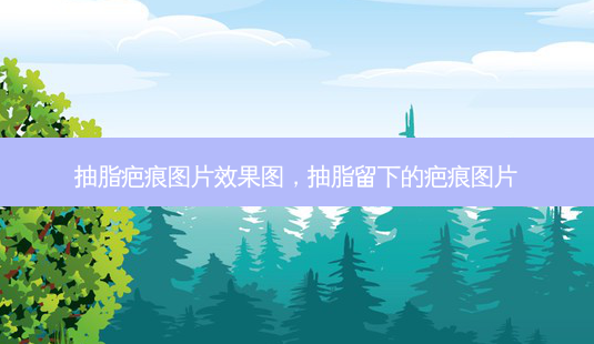 抽脂疤痕图片效果图,抽脂留下的疤痕图片-第1张图片-南山整形网 抽脂疤痕图片效果图,抽脂留下的疤痕图片-第1张图片-南山整形网