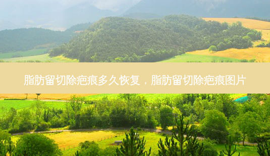 脂肪留切除疤痕多久恢复,脂肪留切除疤痕图片-第1张图片-南山整形网 脂肪留切除疤痕多久恢复,脂肪留切除疤痕图片-第1张图片-南山整形网