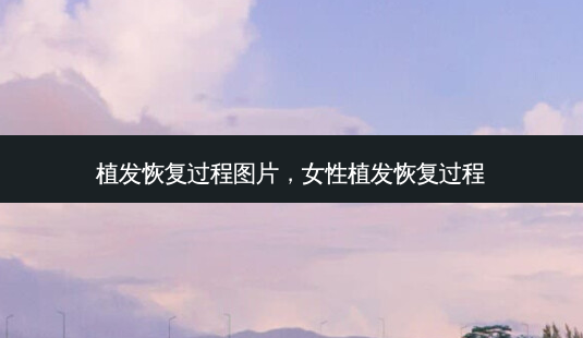 植发恢复过程图片,女性植发恢复过程-第1张图片-南山整形网 植发恢复过程图片,女性植发恢复过程-第1张图片-南山整形网