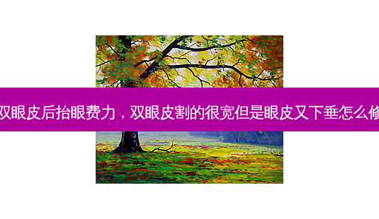 割双眼皮后抬眼费力,双眼皮割的很宽但是眼皮又下垂怎么修复-第1张图片-南山整形网 割双眼皮后抬眼费力,双眼皮割的很宽但是眼皮又下垂怎么修复-第1张图片-南山整形网
