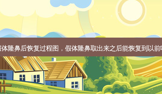 假体隆鼻后恢复过程图,假体隆鼻取出来之后能恢复到以前吗-第1张图片-南山整形网 假体隆鼻后恢复过程图,假体隆鼻取出来之后能恢复到以前吗-第1张图片-南山整形网