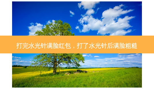 打完水光针满脸红包,打了水光针后满脸粗糙-第1张图片-南山整形网 打完水光针满脸红包,打了水光针后满脸粗糙-第1张图片-南山整形网
