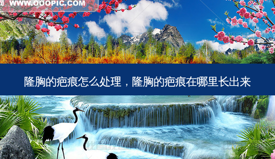 隆胸的疤痕怎么处理,隆胸的疤痕在哪里长出来-第1张图片-南山整形网 隆胸的疤痕怎么处理,隆胸的疤痕在哪里长出来-第1张图片-南山整形网