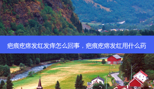 疤痕疙瘩发红发痒怎么回事,疤痕疙瘩发红用什么药-第1张图片-南山整形网 疤痕疙瘩发红发痒怎么回事,疤痕疙瘩发红用什么药-第1张图片-南山整形网