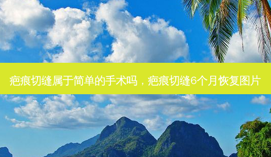 疤痕切缝属于简单的手术吗,疤痕切缝6个月恢复图片-第1张图片-南山整形网 疤痕切缝属于简单的手术吗,疤痕切缝6个月恢复图片-第1张图片-南山整形网