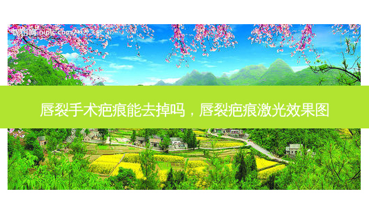 唇裂手术疤痕能去掉吗,唇裂疤痕激光效果图-第1张图片-南山整形网 唇裂手术疤痕能去掉吗,唇裂疤痕激光效果图-第1张图片-南山整形网