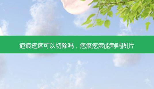 疤痕疙瘩可以切除吗,疤痕疙瘩能割吗图片-第1张图片-南山整形网 疤痕疙瘩可以切除吗,疤痕疙瘩能割吗图片-第1张图片-南山整形网