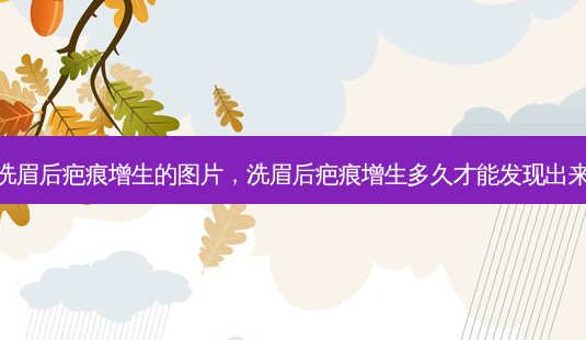 洗眉后疤痕增生的图片,洗眉后疤痕增生多久才能发现出来-第1张图片-南山整形网 洗眉后疤痕增生的图片,洗眉后疤痕增生多久才能发现出来-第1张图片-南山整形网