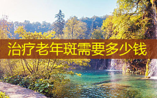 治疗老年斑需要多少钱