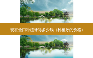 现在全口种植牙得多少钱（种植牙的价格）