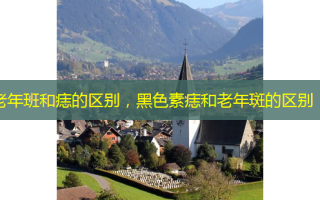 老年班和痣的区别，黑色素痣和老年斑的区别