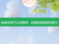 疤痕疙瘩可以切除吗，疤痕疙瘩能割吗图片